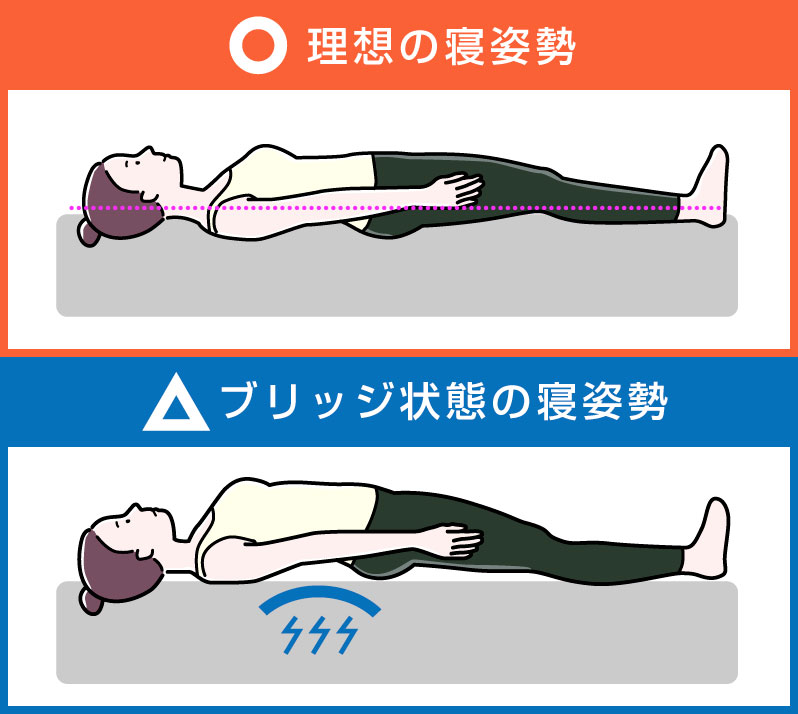 3. 【要チェック】あなたの寝姿勢は「ブリッジ状態」になっていませんか?
